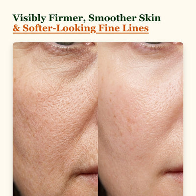 Choglow anti-aging oil before and after firmer smoother skin