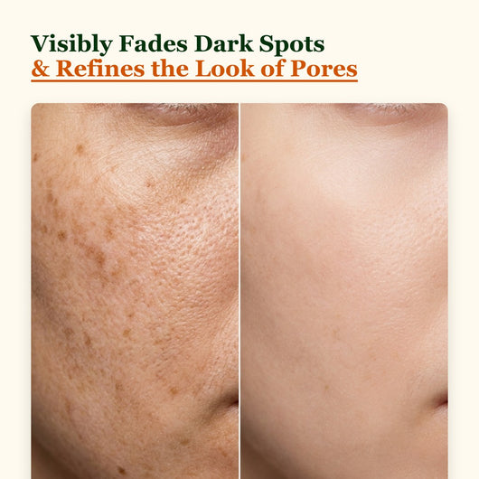 Choglow dark spot oil before and after fading dark spots in 4 weeks