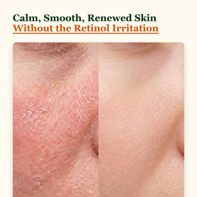 Choglow retinol alternative before and after calm smooth skin