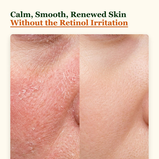 Choglow retinol alternative before and after calm smooth skin