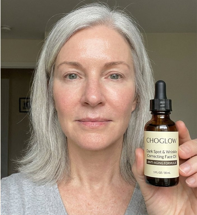 Choglow face oil real customer transformation