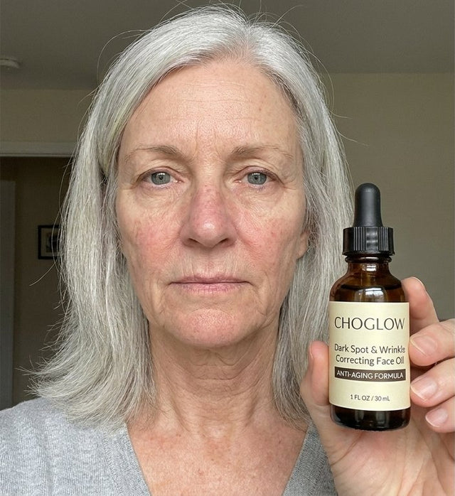 Choglow face oil real customer transformation