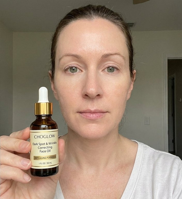 Choglow face oil real customer transformation