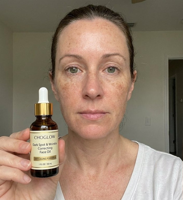 Choglow face oil real customer transformation
