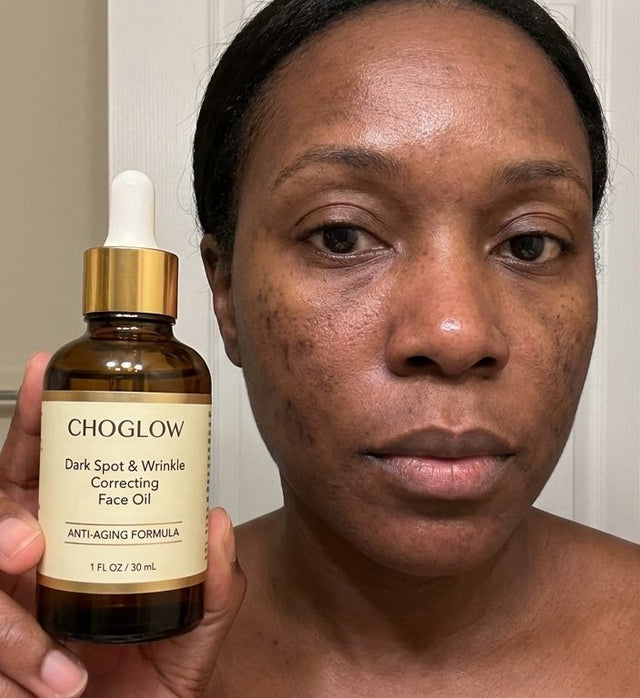 Choglow face oil real customer transformation