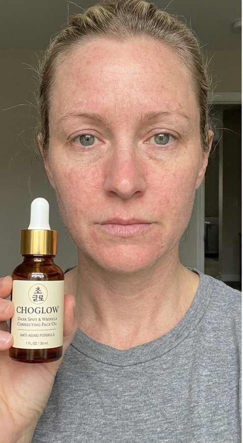 Choglow face oil real customer transformation