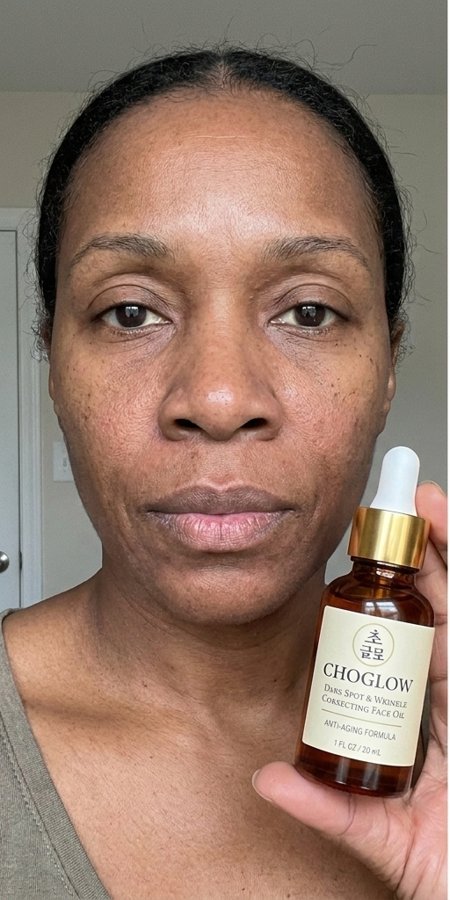 Choglow face oil real customer transformation