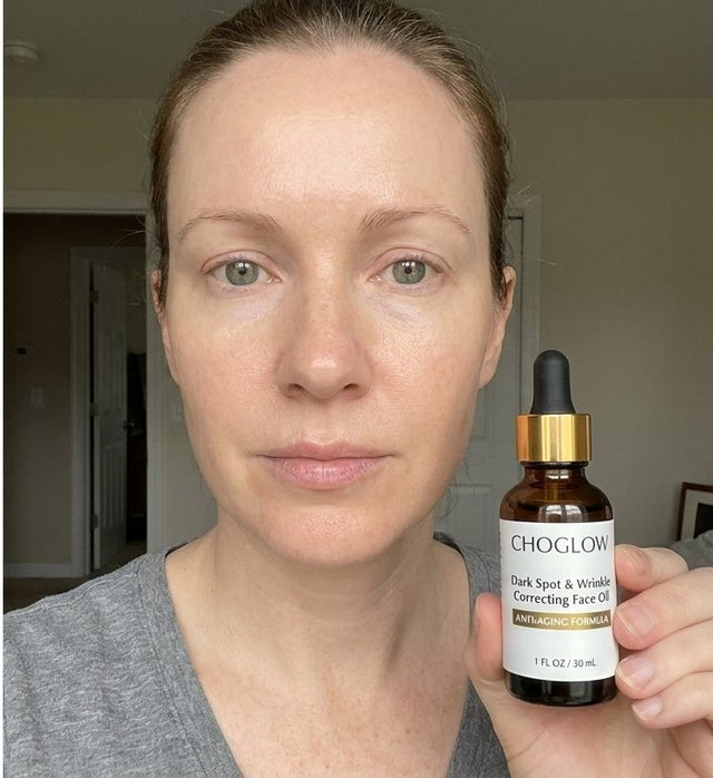 Choglow face oil real customer transformation