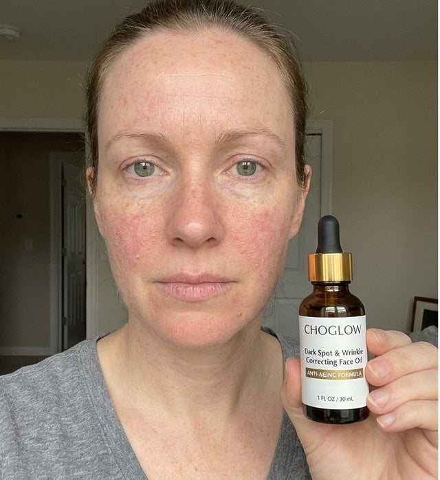 Choglow face oil real customer transformation